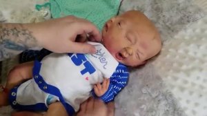 Необычные Сиамские Близнецы, Которые Существуют На Самом Деле