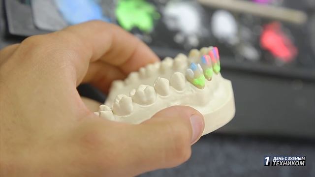 1 День с Зубным Техником”  | Как стать лучшим Зубным Техником? | Dental Day| #AghaMehdi смотреть онлайн