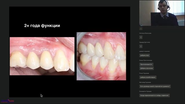 "Пластика мягких тканей вокруг имплантатов."(08.10.2019) смотреть онлайн
