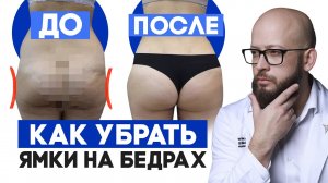 Как увеличить бедра в ширину и убрать ямки на ягодицах