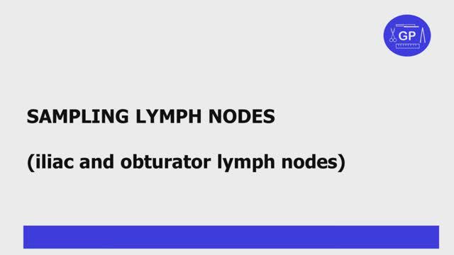 Sampling lymph nodes (iliac and obturator)