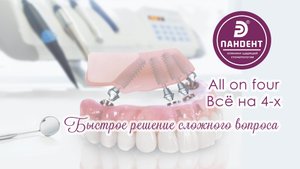 All on four альтернатива съёмной челюсти