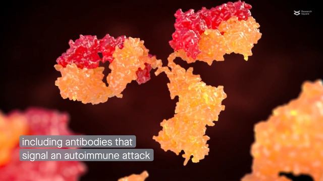 SARS-CoV-2 spike protein worsens rheumatoid arthritis in mice смотреть онлайн
