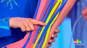 Нужно ли лечить варикоз. Жить здорово! Фрагмент выпуска от 12.03.2018