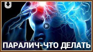 ПАРАЛИЧ - ЧТО ДЕЛАТЬ.mp4