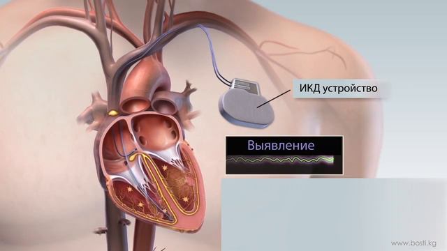икд смотреть онлайн