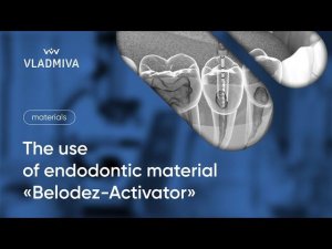 The use of endodontic material "Belodez-Activator"