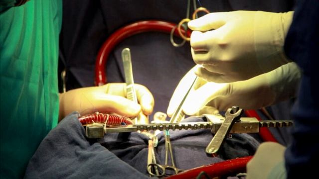 51 летняя женщина, судя по всему, съела слона. Но врачи раскрыли страшную правду! смотреть онлайн