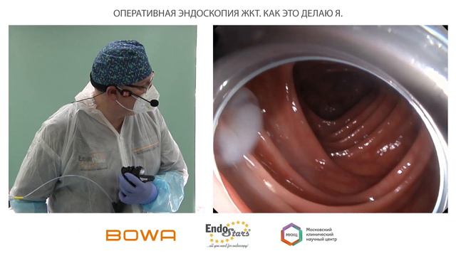 Петлевая резекция слизистой. Оперативная эндоскопия.