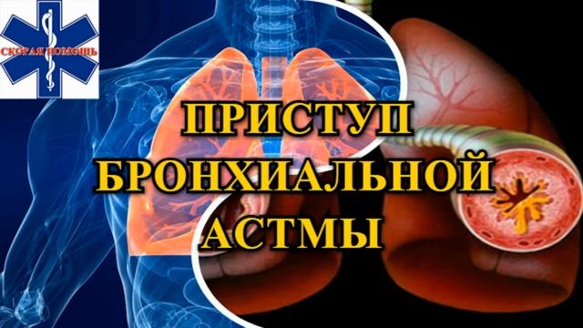 Приступ бронхиальной астмы смотреть онлайн