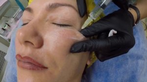 «МЕЗОДИССОЛЯЦИЯ» удаление малярных мешков липолитиками