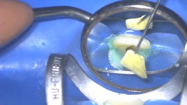 10 ева создание пробки смотреть онлайн