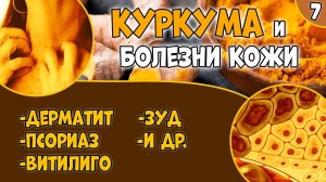 КУРКУМА (видео 7): болезни кожи. Псориаз. Дерматит. Витилиго.