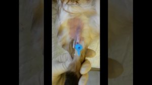 2 постановка в.в катетера