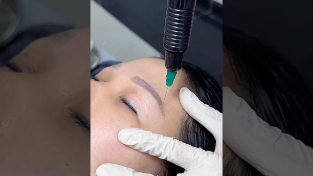 Combor Xoá sẹo - xoá xăm - Xử lí thâm mắt - Tatoo removal #Treatment scar  #plasmaacademy