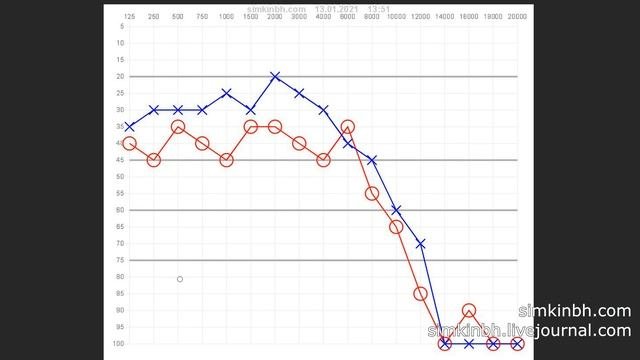 Слышать до 14000Гц. Мало?! Исправления слуха. Практика