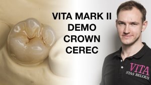 Обучение моделировке CEREC коронка Моляр окрашивание Tutorial Vita Mark2 Akzent Plus #vitazahnfabrik