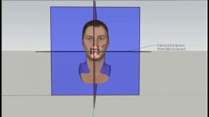Плоскости черепа (сагиттальная, горизонтальная, фронтальная) разница между латеральным и дистальным