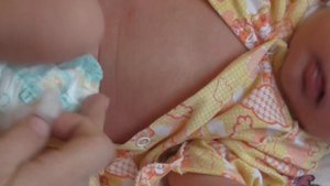 Как лучше всего обрабатывать пупок новорожденного