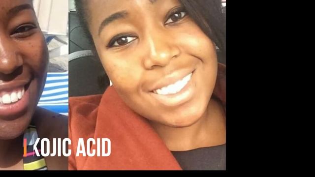 Remedies For More Even Skin смотреть онлайн