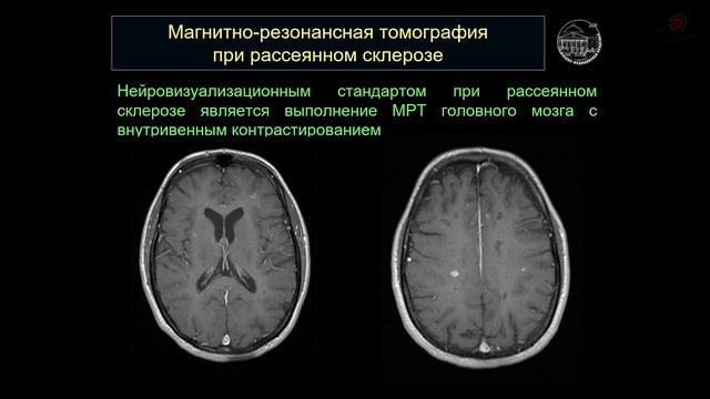 Методы нейровизуализации в практике врача.