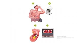 Капсульная эндоскопия