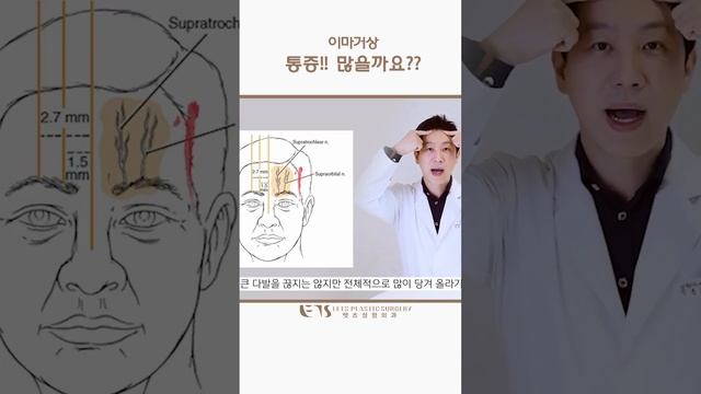 #내시경이마거상 #대구이마거상 #대구성형외과 смотреть онлайн