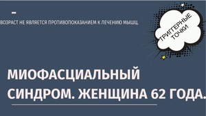 Миофасциальный синдром. Женщина 62 года.