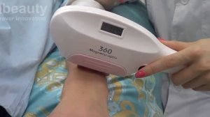 360 magneto-optical hair removal machine