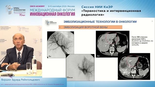 Приоритетные интервенционные радиологические технологии в лечении онкобольных. смотреть онлайн