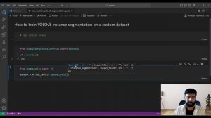 How to train YOLOv8 instance segmentation on a custom dataset