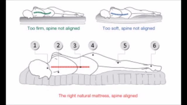 На каком матрасе нужно спать при сколиозе
