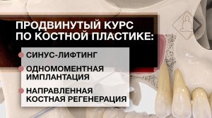 Анонс видео-курса: продвинутый курс по костной пластике.