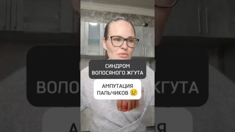 ⚠️СИНДРОМ ВОЛОСЯНОГО ЖГУТА. АМПУТАЦИЯ ПАЛЬЧИКОВ