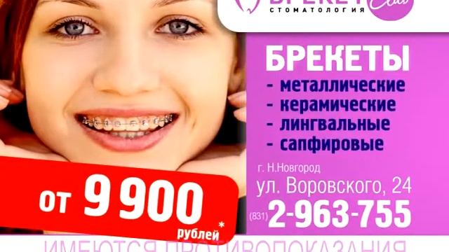 Новый рекламный ролик Брекетов