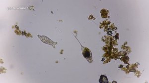 Микробы в озере под микроскопом # 1