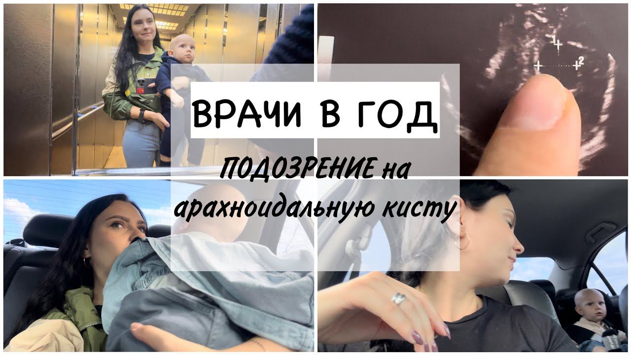 ДИСПАНСЕРИЗАЦИЯ в годик ⚕️ АРАХНОИДАЛЬНАЯ КИСТА ПОД ВОПРОСОМ / МРТ ребенку