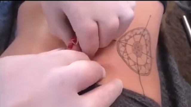 ВЫДАВЛИВАЕМ ПРЫЩИ