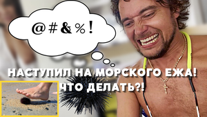 Морских ежей везде много и травмы неизбежны - Учу спасаться от игл морского ежа