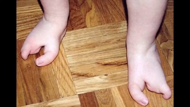 5 Шокирующих генетических мутаций, встречающихся у людей смотреть онлайн