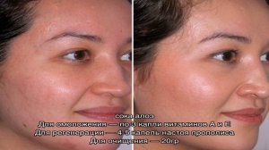 Все о парафиновых масках для лица, рук, ног. Когда и как делать домашние маски из парафина, как до.