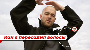 Пересадка волос в 24 года