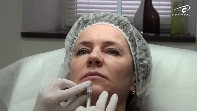 Разная длинна губ - как быть? смотреть онлайн