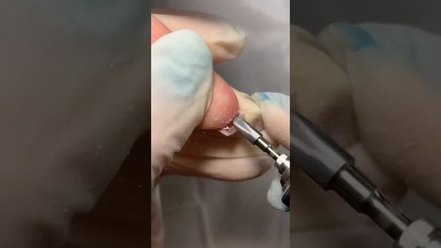Вниз растущие ногти. Выравнивание архитектуры поли-гелем #nails #shorts #manicure