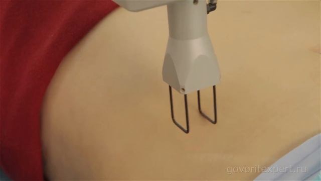 Растяжки и рубцы+ смотреть онлайн