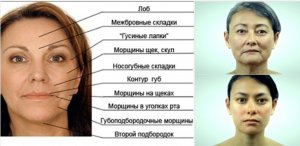 Кожа шеи и лица: методы омоложения, упражнения для нижней челюсти