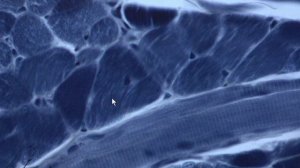 #Поперечнополосатая скелетная #мышечная ткань