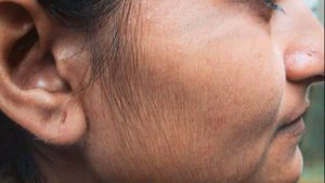 Yoqimsiz tuklardan halos bo'lish usullari Йокмсиз туклардан халос болиш усуллари