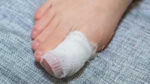 Лучшее средство от ГРИБКА НОГТЕЙ. Это копеечное средство уберет ГРИБОК НОГТЕЙ за 15 минут