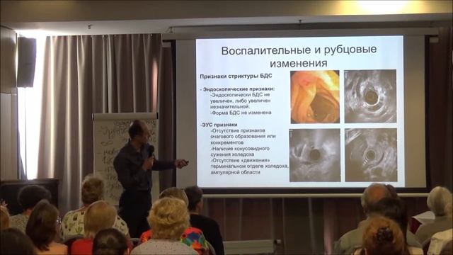 18.06.19 ЭндоУЗИ и другие исследования для диагностики и лечения ЖКБ ЖКБ смотреть онлайн